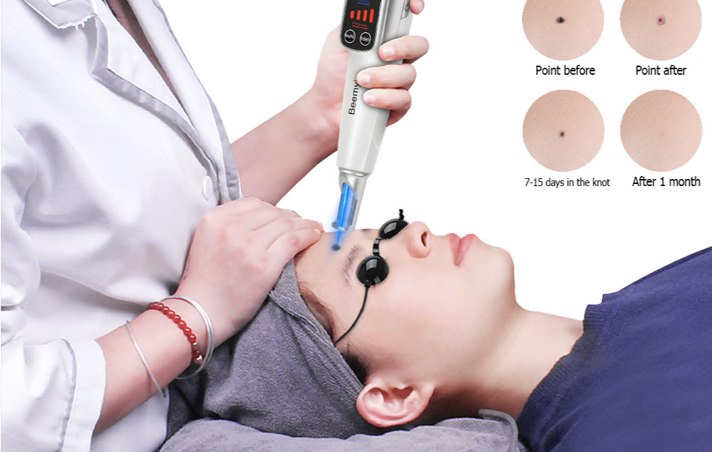 激光祛斑美容儀安全認(rèn)證(圖1)